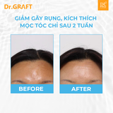 SPIDERMA + SPICULE I Tinh chất dưỡng ẩm da đầu Spiderma Spicule-12lọ x 5ml