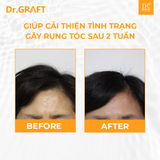 Dr.GRAFT Aranea Shampoo | Dầu gội Dr.GRAFT Aranea - 500ml
