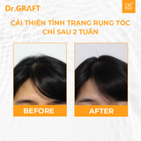 Dr.GRAFT Scalp Tonic | Xịt dưỡng da đầu Dr.GRAFT Scalp Tonic - 100ml