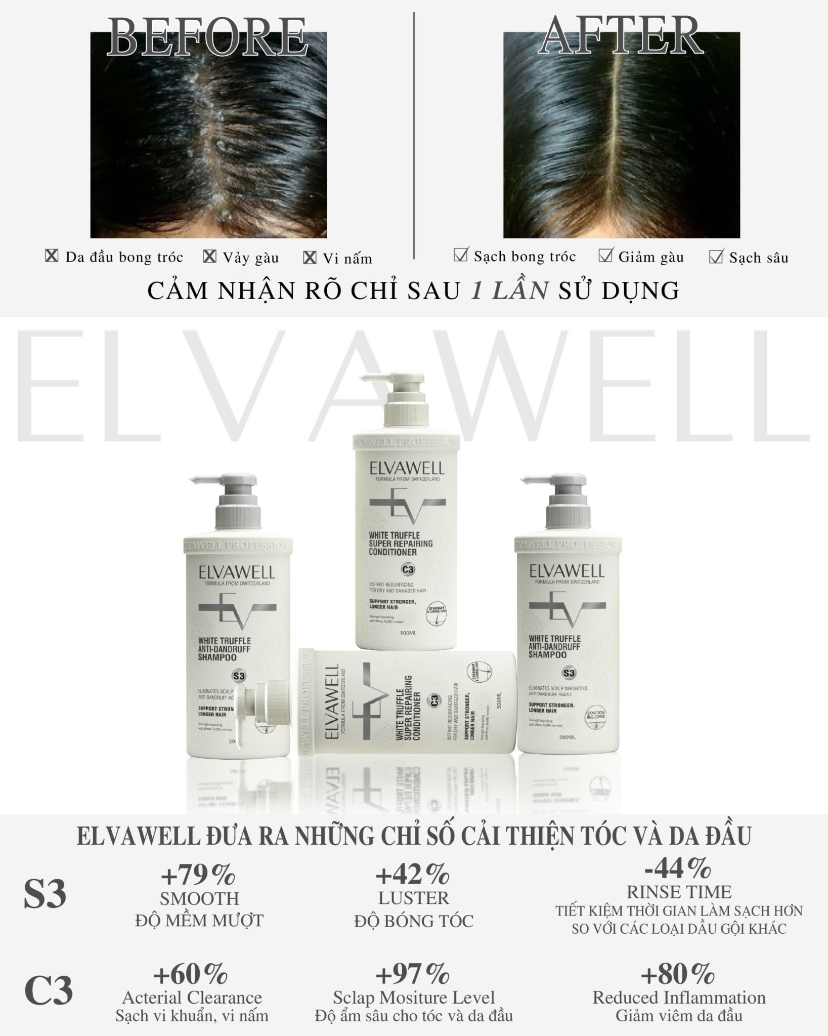Dầu gội giảm gàu siêu suôn mượt Elvawell 500ml