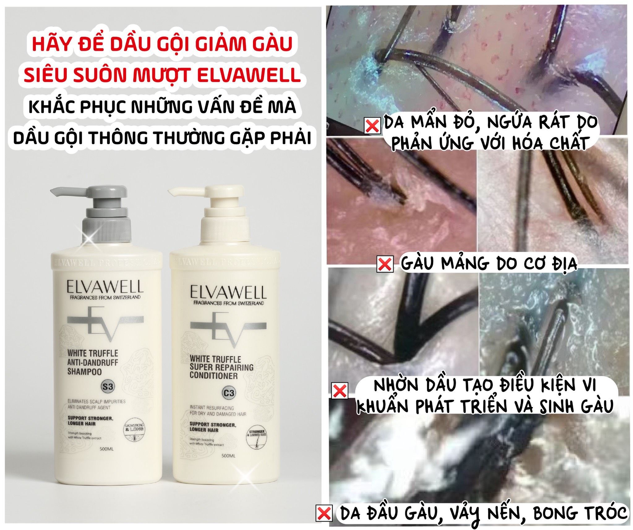 Dầu gội giảm gàu siêu suôn mượt Elvawell 1000ml