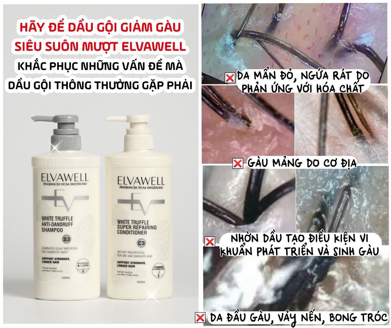 Dầu gội giảm gàu siêu suôn mượt Elvawell 500ml