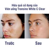  TRANSINO-Viên uống cải thiện nám WhiteC Clear120v 