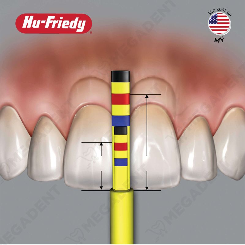 Papilla Replacement Tips - Đầu đo gai nướu tỉ lệ kéo dài thân răng - Hộp 3 cái