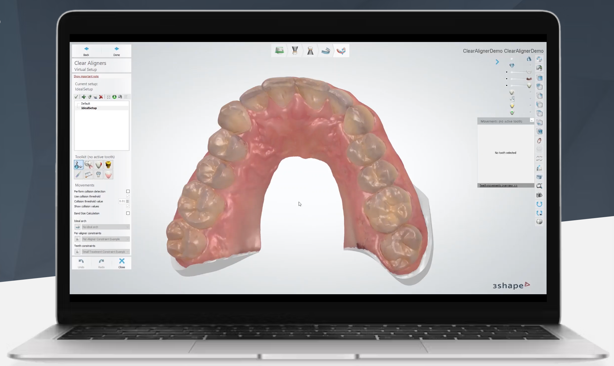Ortho Planner - Phần mềm lập kế hoạch điều trị nha khoa