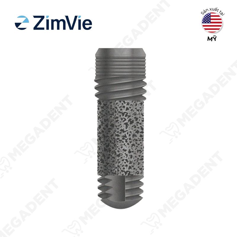 IMP TM MTX FULL - Implant Trabecular - Hộp 1 cái