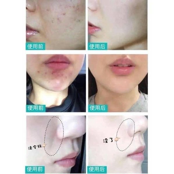 Kem dưỡng REJURAN Healer Turnover Cream 50ml