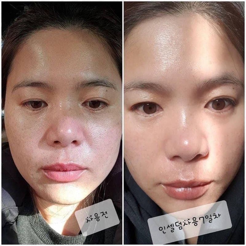 Kem dưỡng REJURAN Healer Turnover Cream 50ml