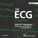  150 ECG Problems 