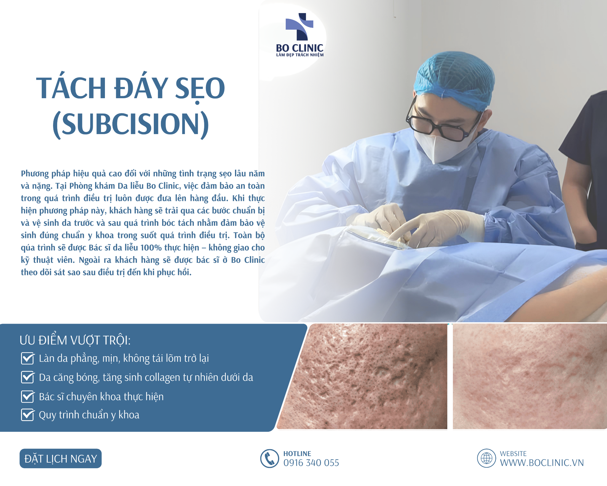Tách Đáy Sẹo - Phương Pháp Điều Trị Các Loại Sẹo Hiệu Quả Nhất Hiện Nay