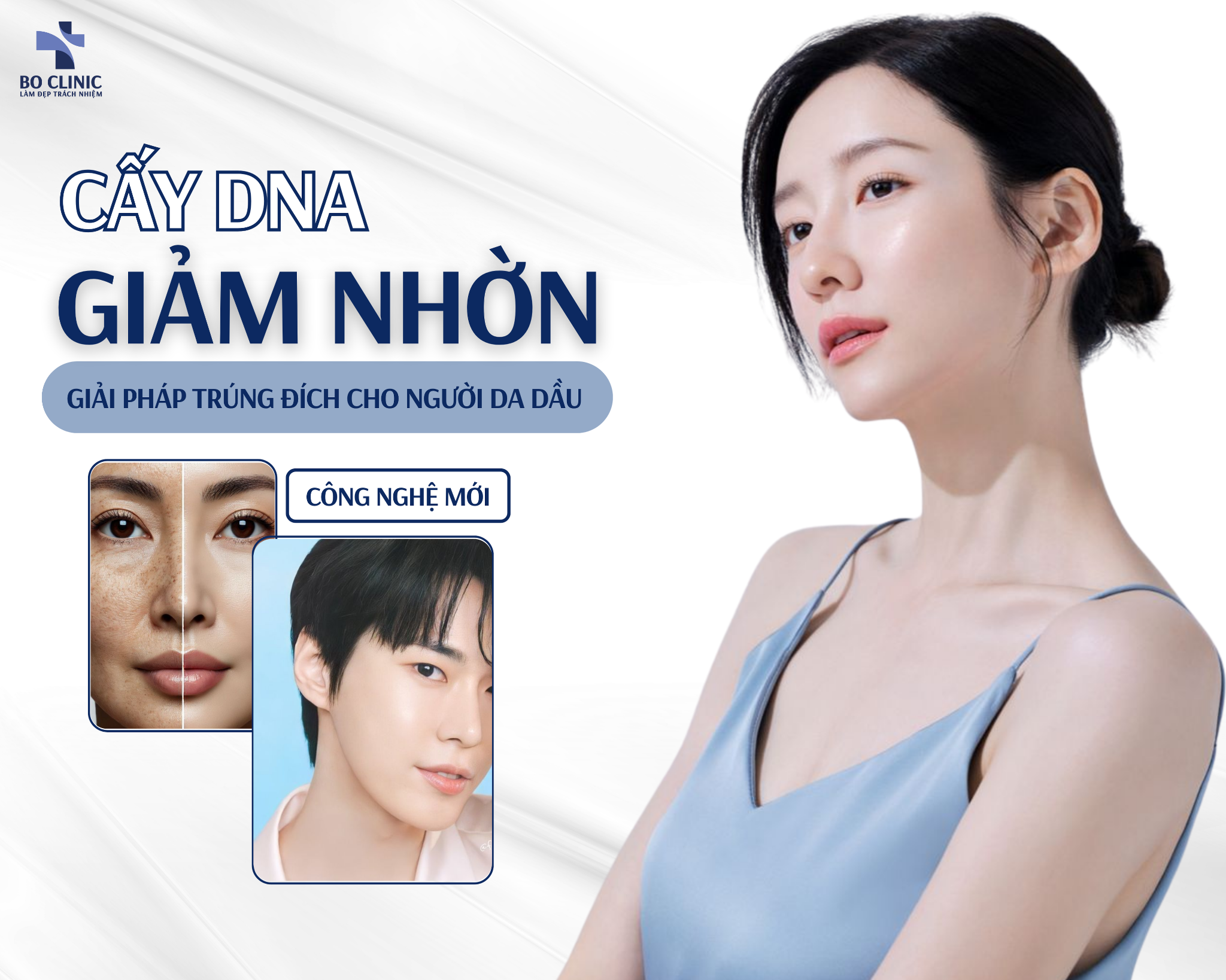 Công Nghệ Cấy DNA Giảm Nhờn - Thu Nhỏ Lỗ Chân Lông, Kiềm Dầu Nhờn Cho Da Mặt Hiệu Quả