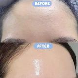 A310 - Serum phục hồi và cấp ẩm Smas Pro Vitamin B5 120g