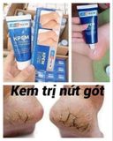 B347- Kem trị Nứt gót chân KPEM nga