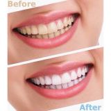 A708- Kem đánh răng colgate total mỹ 181g