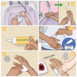 A326- Thuốc trị phỏng, vết thương Neosporin 28.3g