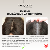 TOUPEE 1 NGÔI VIỀN REN (FORM MỎNG)