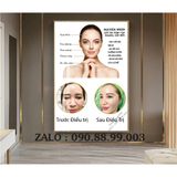 Tranh triệt lông tráng gương cho spa thẩm mỹ viện Tranh Quảng Cáo Cao Cấp