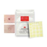 Miếng Dán Mụn Cosrx Acne Pimple 24 Patches