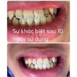 Bột than tre hoạt tính làm trắng răng Zenpali
