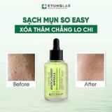 A323 - Serum giảm mụn Kyung Lab Acnes Centella Asiatica Ampoule 50ml