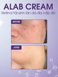 A152 - Kem retinol Kyung Lab Alab 30ml