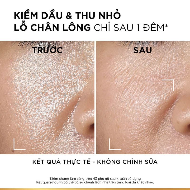 Serum L'Oreal Kiềm Dầu Ban Đêm Niacinamide 2% Revitalift Hyaluronic Acid Oil Control Serum 30ml