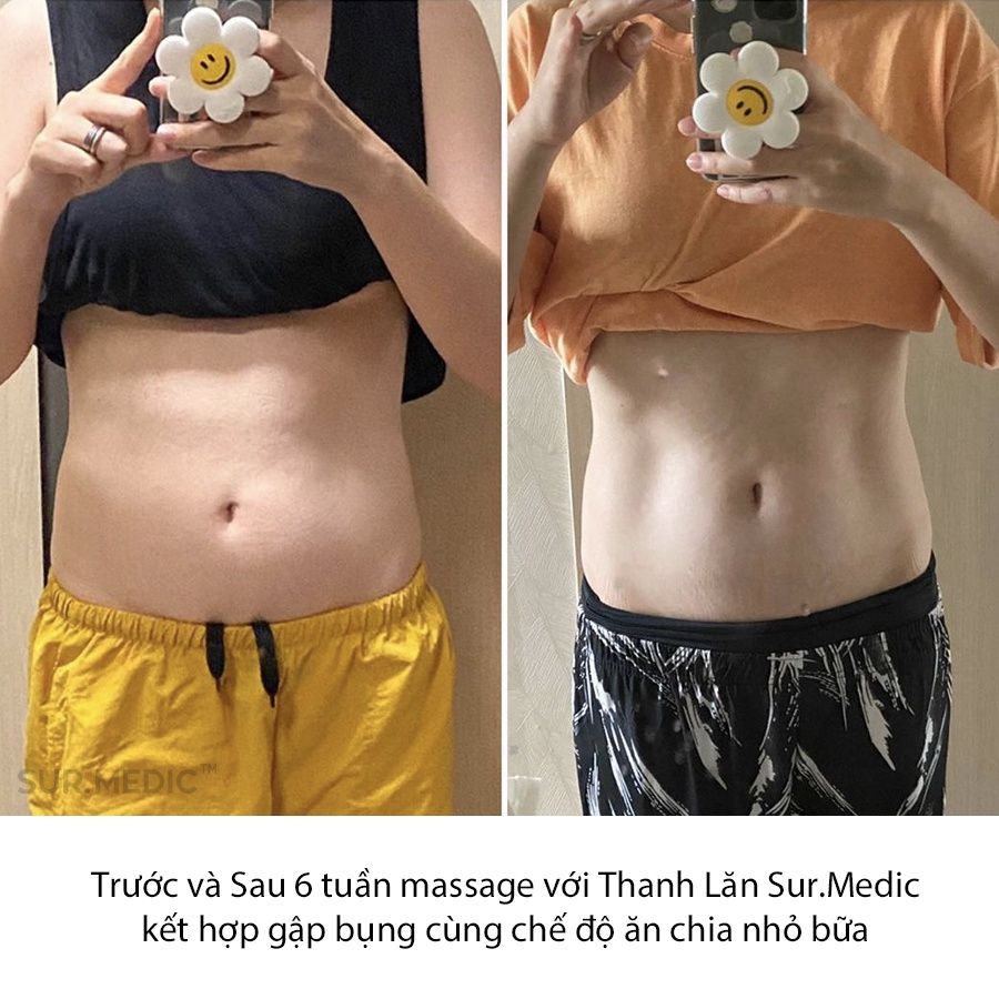 Thanh Lăn Massage Tan Mỡ Sur.Medic+ Săn Cơ Định Hình Body Fil Body Hot Gel Cream 100ml