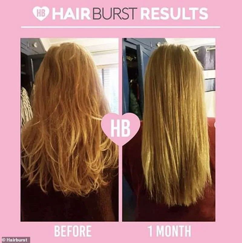 Bộ Dầu Gội Xả Kích Thích Tóc Mọc Dài & Khỏe Hairburst For Longer Stronger Hair 350ml