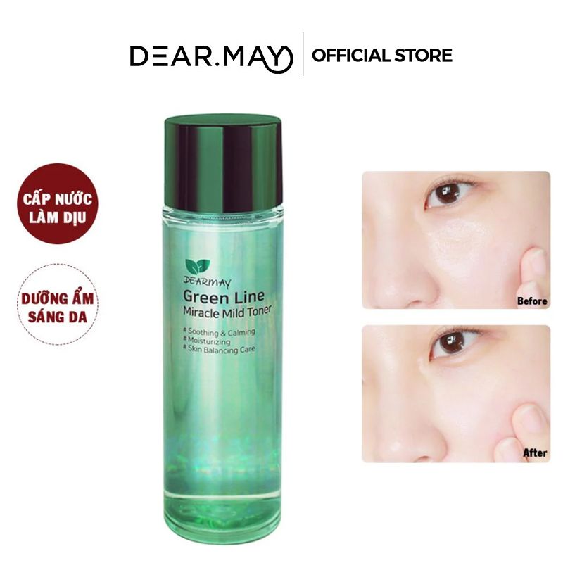 Nước Hoa Hồng Cân Bằng, Làm Dịu Da Chiết Xuất Thiên Nhiên Dearmay Green Line Miracle Mild Toner 150ml