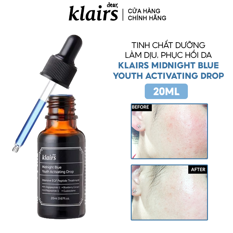 Tinh Chất Dưỡng Làm Dịu Da Klairs Midnight Blue Youth Activating Drop – THẾ GIỚI SKINFOOD