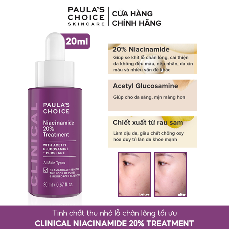 Tinh Chất Dưỡng Da Se Khít Lỗ Chân Lông Paula's Choice Niacinamide 20% Treatment 20ml