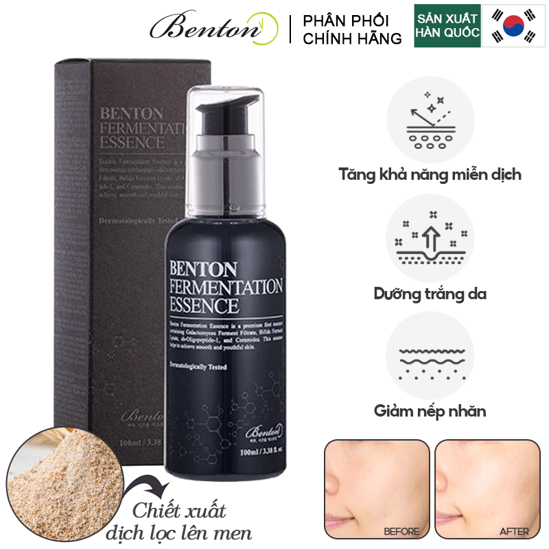 Serum Benton Tinh Chất Dưỡng Da Chống Lão Hóa, Giúp Da Săn Chắc Với Dịch Lọc Lên Men Benton Fermentation Essence 100ml