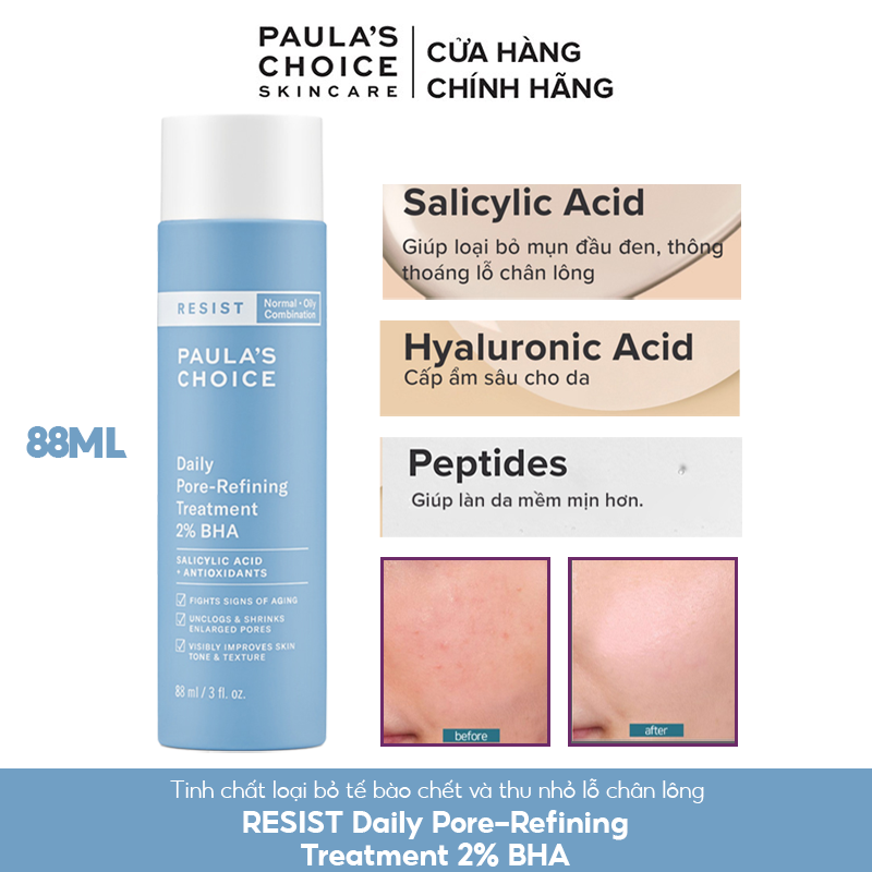 Tẩy Tế Bào Chết Hóa Học Giúp Se Khít Lỗ Chân Lông Paula's Choice Resist Daily Pore-Refining Treatment 2% BHA 88ml