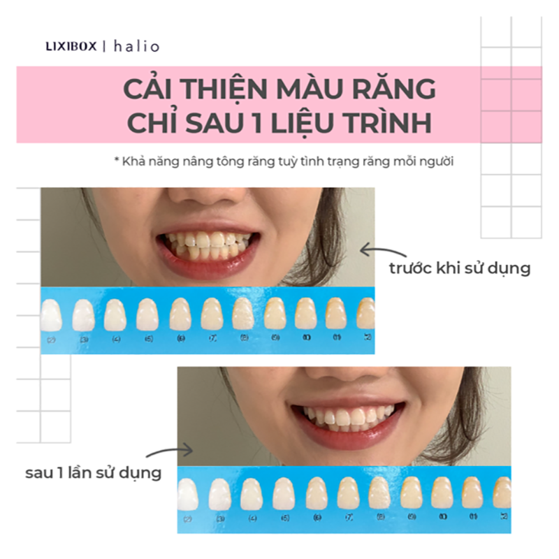 Miếng Dán Trắng Răng An Toàn Ít Ê Buốt Halio Teeth Whitening