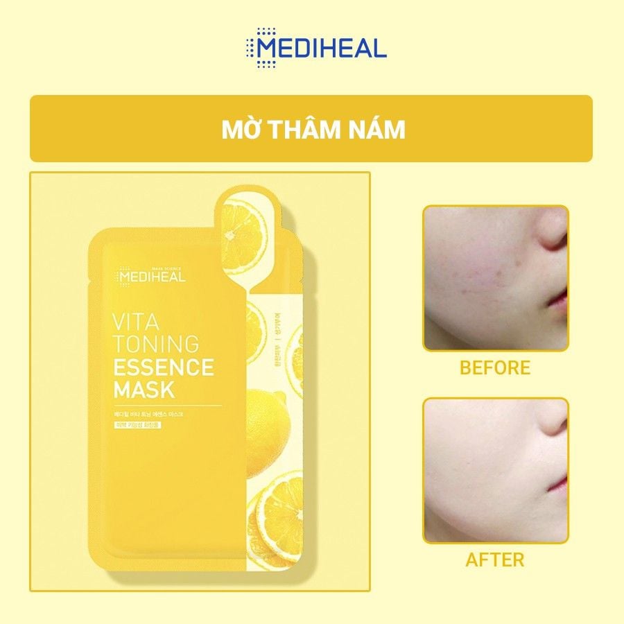 Mặt Nạ Mediheal Cấp Ẩm, Dưỡng Sáng Da Mask 20ml