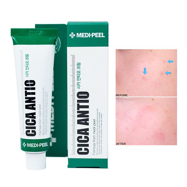 Kem Dưỡng Medi-Peel Làm Dịu, Cải Thiện Da Cica Antio Cream 30ml
