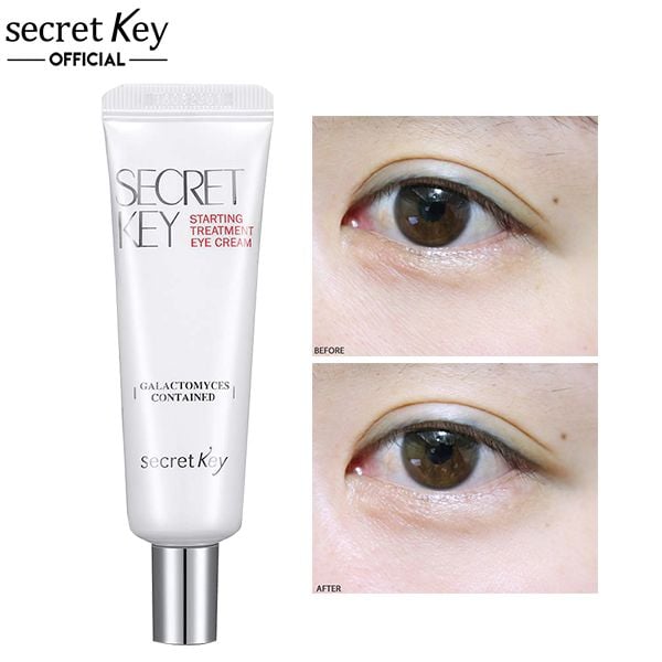 Kem Dưỡng Mắt Secret Key Hỗ Trợ Nâng Cơ, Giảm Quầng Thâm Mắt Starting Treatment Eye Cream 30g
