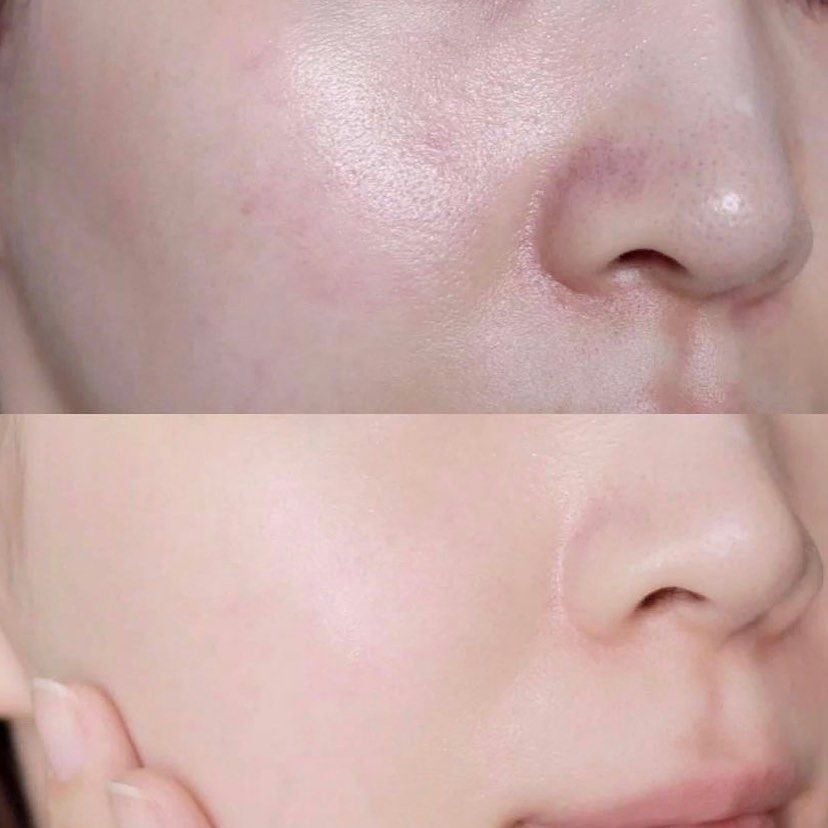 Serum Skin1004 Dưỡng Ẩm, Hỗ Trợ Làm Sáng Da Madagasca Centella Hyalu-Cica Blue Serum 50ml