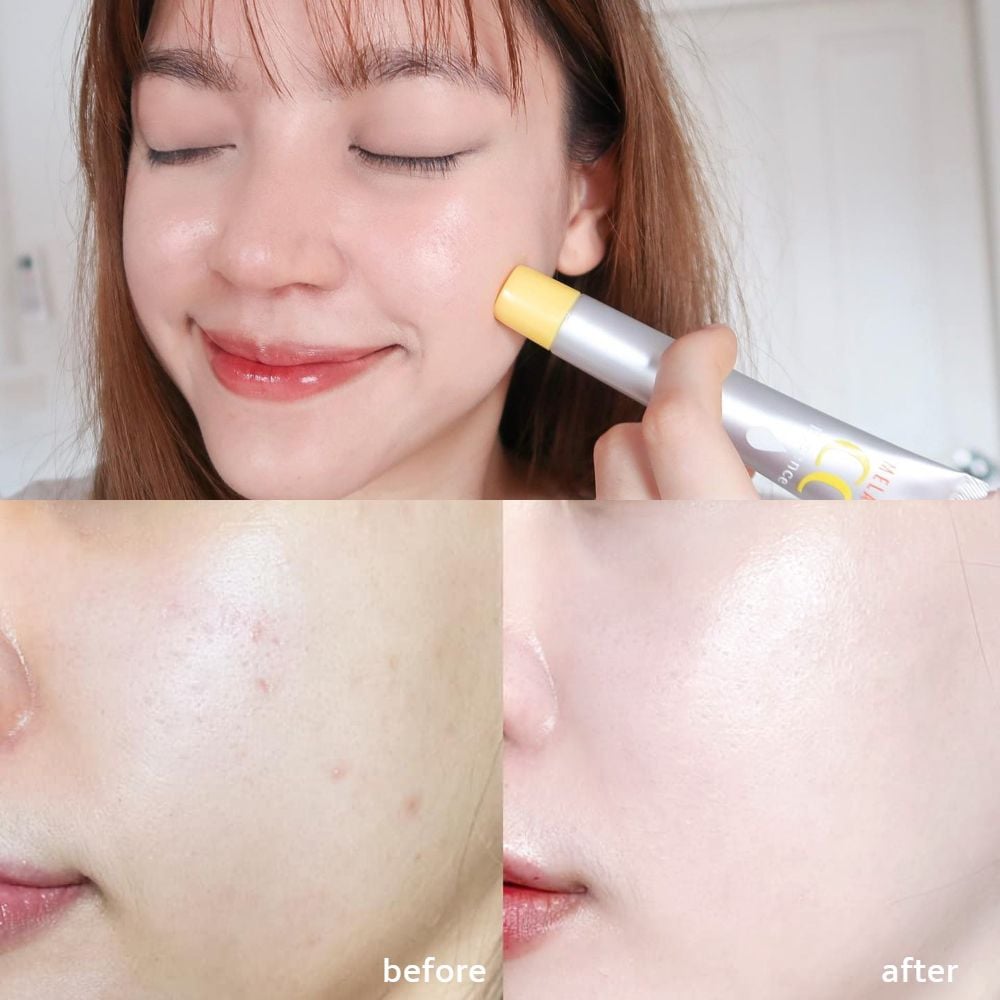 Tinh Chất Melano CC Hỗ Trợ Dưỡng Sáng Da, Mờ Thâm Nám Whitening Essence 20ml