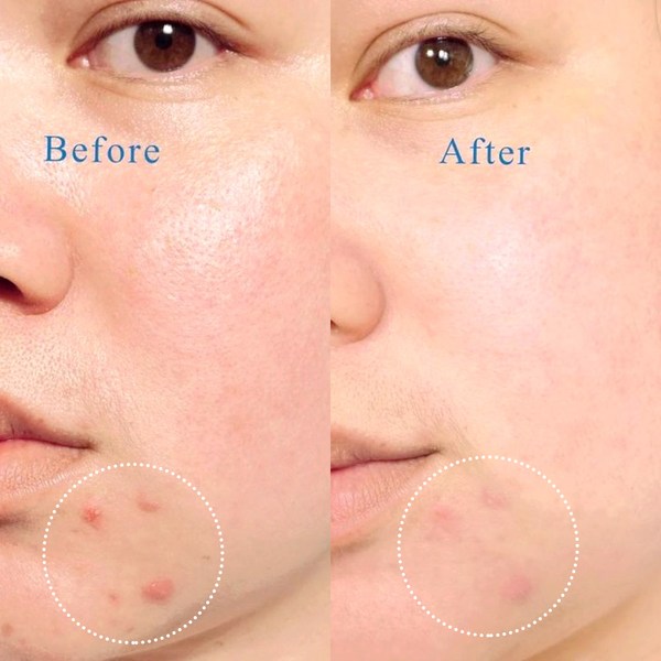  Sữa Rửa Mặt Dạng Gel Cho Da Dầu Mụn La Roche-Posay Effaclar Purifying Foaming Gel For Oily Sensitive Skin 