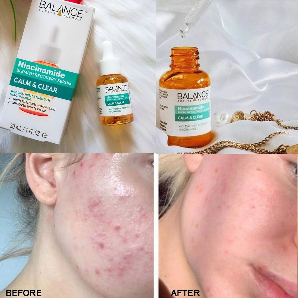 Serum Balance Active Formula Ngừa Mụn Mờ Thâm Niacinamide Blemish Recovery Serum 30ml