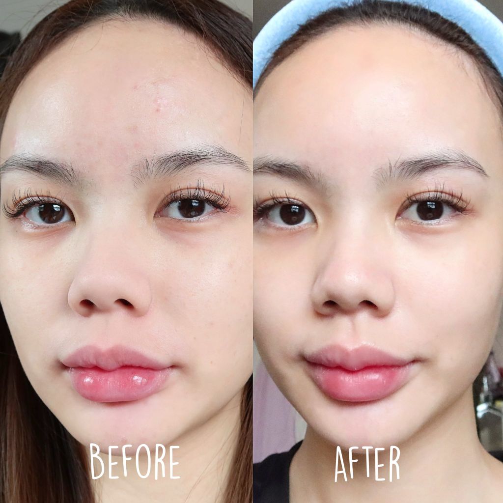 Sữa Rửa Mặt Garnier 3 Trong 1 Hỗ Trợ Giảm Mụn, Hỗ Trợ Dưỡng Sáng Da Bright Complete 3-in-1 Anti-Acne Foam 100ml