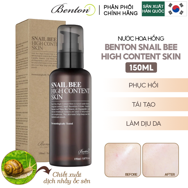  Nước Hoa Hồng Hỗ Trợ Phục Hồi, Làm Dịu Da Benton Snail Bee High Content Skin 150ml 