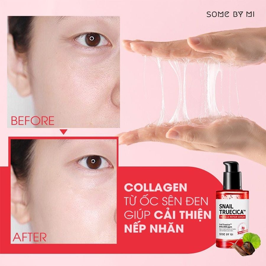Serum Some By Mi Tinh Chất Ốc Sên Hỗ Trợ Mờ Thâm Sẹo Hàn Quốc Snail Truecica Miracle Repair Serum 50ml