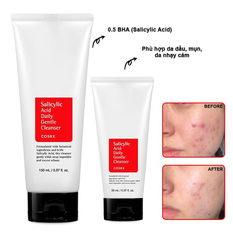 Sữa Rửa Mặt Cosrx Salicylic Acid Daily Gentle Cleanser 150ml