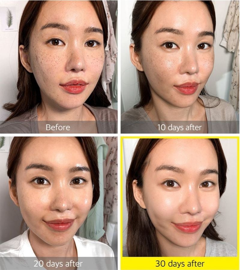 Serum Some By Mi Tinh Chất Hỗ Trợ Dưỡng Trắng Da Chiết Xuất Quả Thanh Yên Some By Mi Yuja Niacin 30 Days Blemish Care Serum 50ml