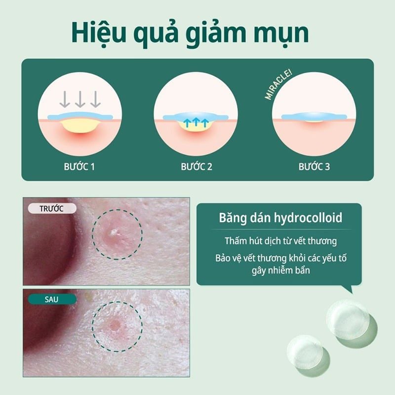 Miếng Dán Mụn Some By Mi Clear Spot Patch - Set 18 miếng