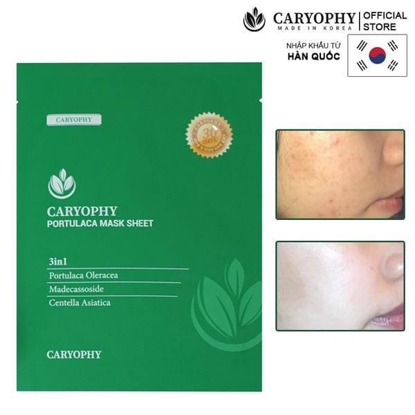  Mặt Nạ Miếng Caryophy Làm Dịu, Hỗ Trợ Phục Hồi Dành Cho Da Dầu Mụn Portulaca Mask Sheet 
