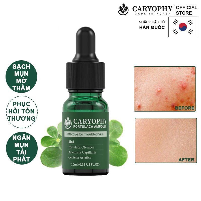 Tinh Chất Caryophy Chăm Sóc Cho Da Mụn Portulaca Ampoule 30ml