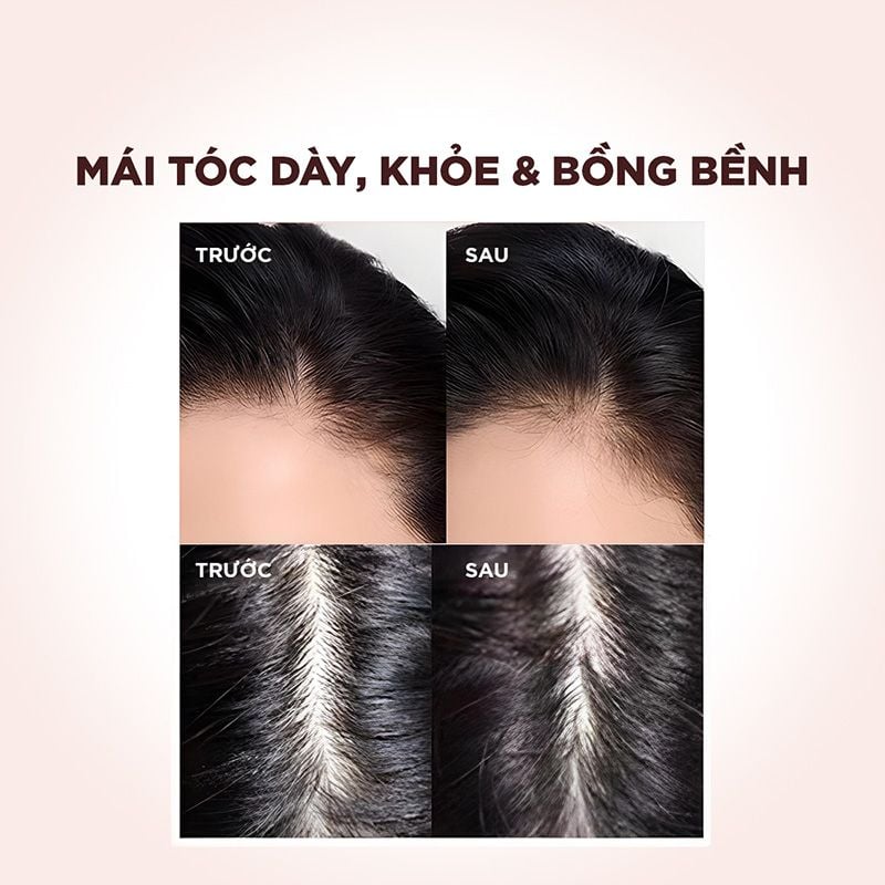 Dầu Gội, Dầu Xả Giảm Rụng Tóc, Giúp Tóc Chắc Khỏe L'oreal Full Resist 440ml